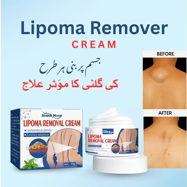 South Moon Lipoma Removel Cream (Ornginal)