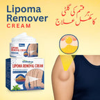 South Moon Lipoma Removel Cream (Ornginal)